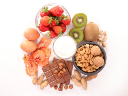 food allergies