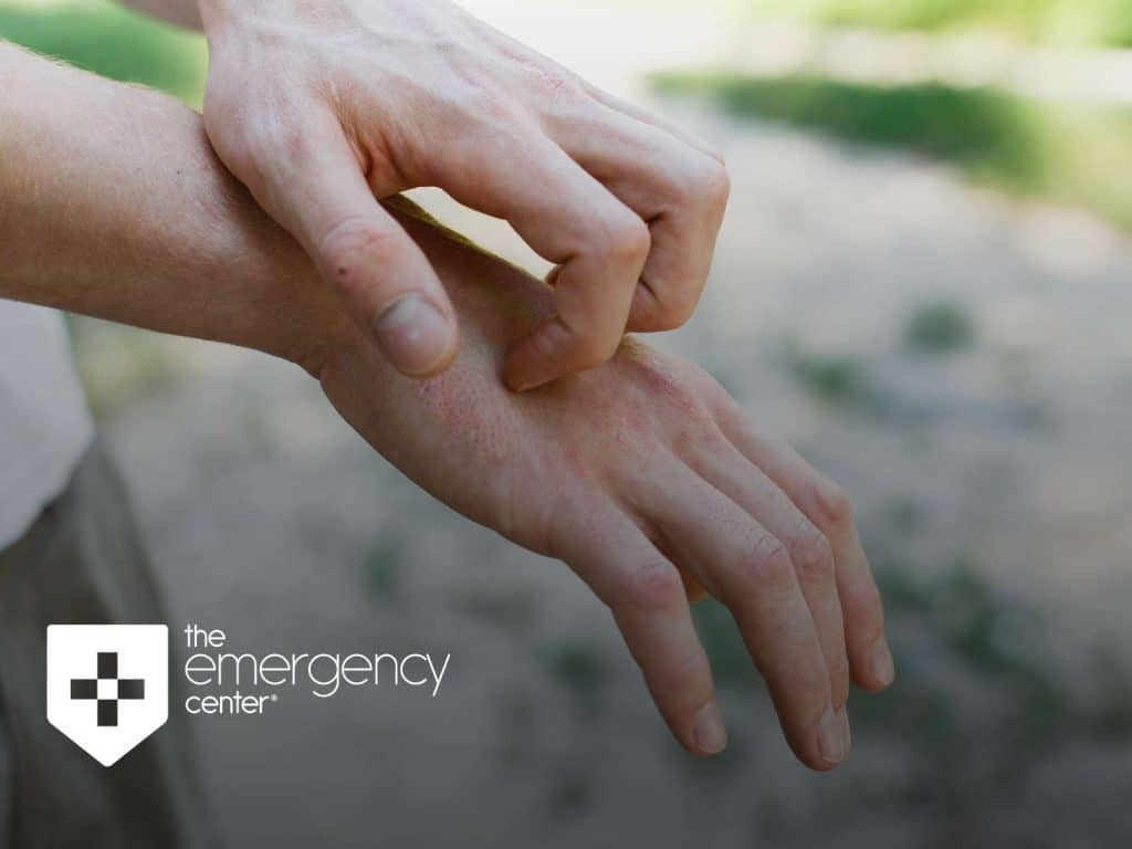 When a Rash Requires a Trip To The ER